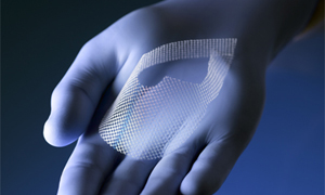 Boston-Scientific-transvaginal-mesh-vaginal-mesh-prolapse-mesh-pelvic-mesh-Uphold-mesh_large