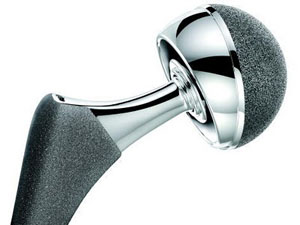 /depuy-asr-hip-implant-replacement-recall-lawsuit/